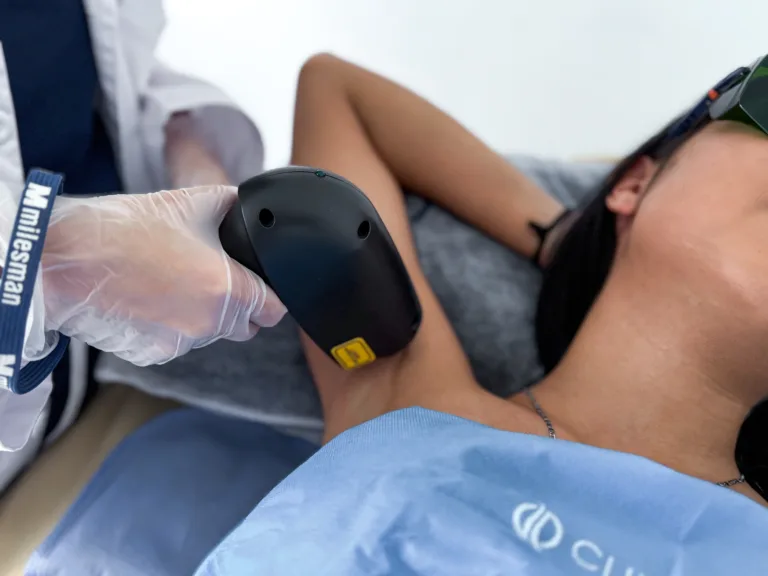 depilacion con laser diodo de axilas